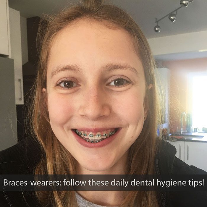 Daily Dental Hygiene Tips for Braces Wearers Paschen Orthodontics
