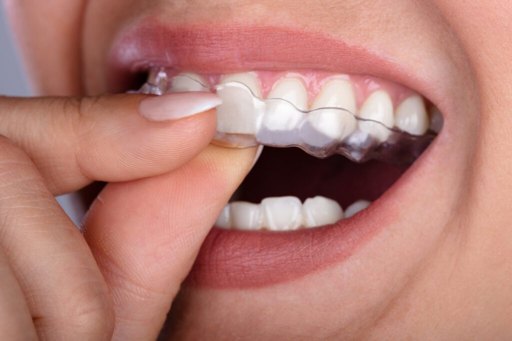 Paschen Orthodontics -
