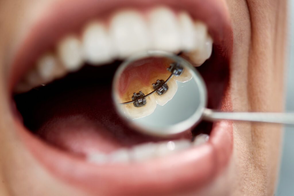 Paschen Orthodontics -