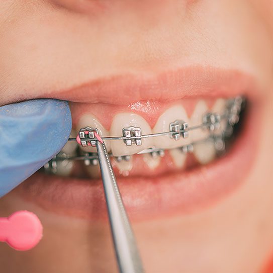 Paschen Orthodontics -