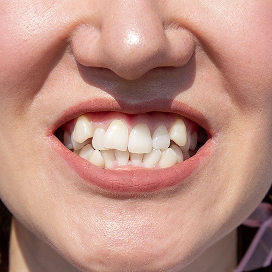 Paschen Orthodontics -
