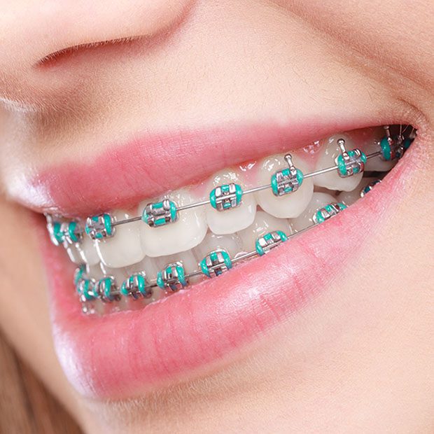 Paschen Orthodontics -