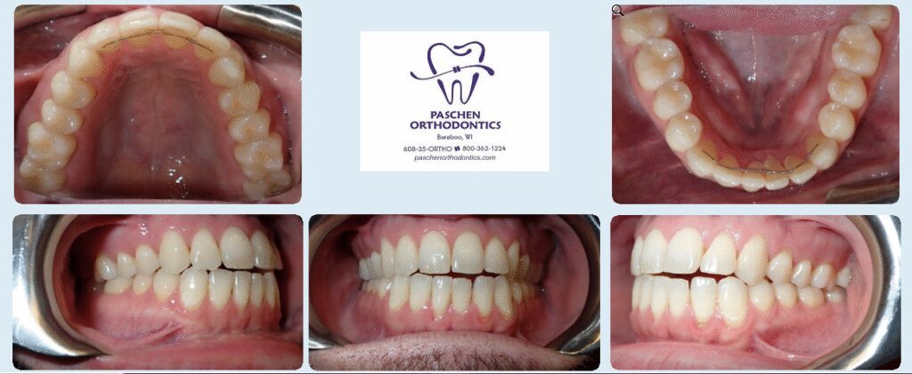 Paschen Orthodontics -