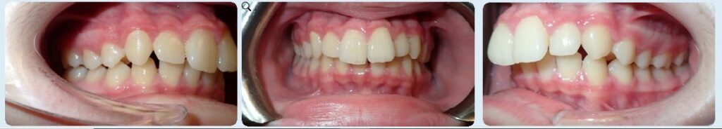 Paschen Orthodontics -