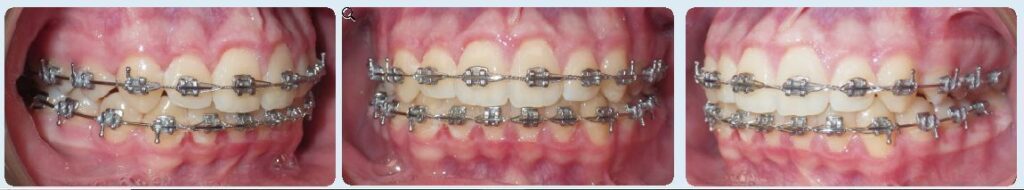 Paschen Orthodontics -