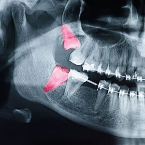 Paschen Orthodontics -