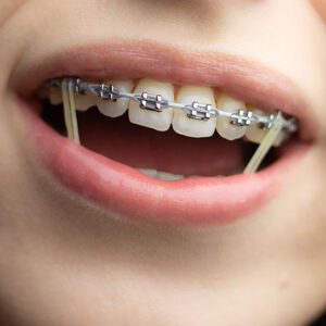 Paschen Orthodontics -